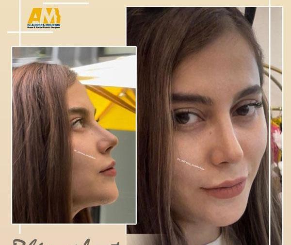 عکس بینی فانتزی عروسکی