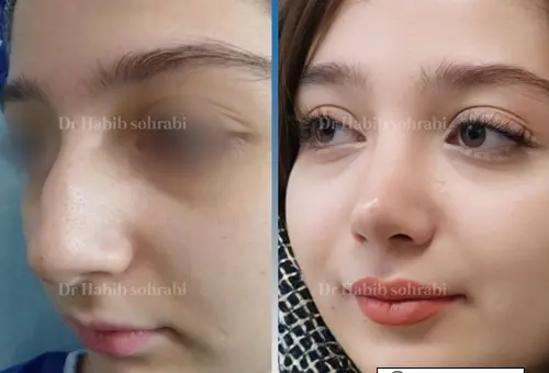 عکس بینی فانتزی عروسکی