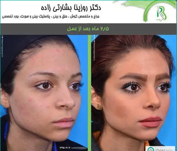 عکس بینی فانتزی عروسکی