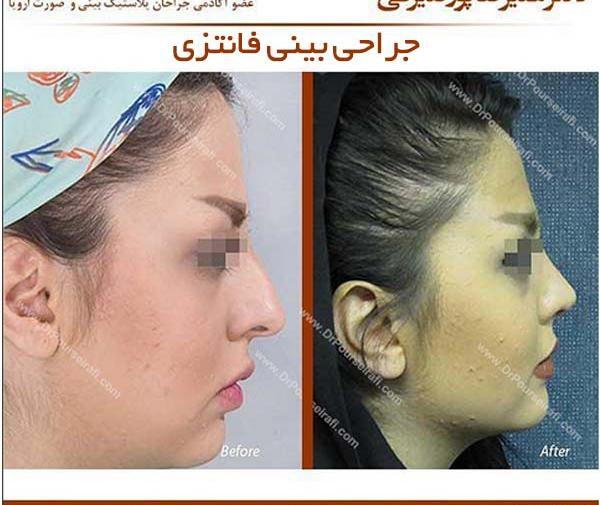 عکس بینی فانتزی عروسکی