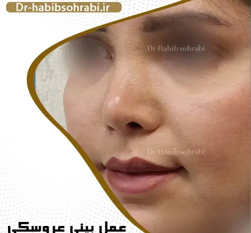 عکس بینی فانتزی عروسکی
