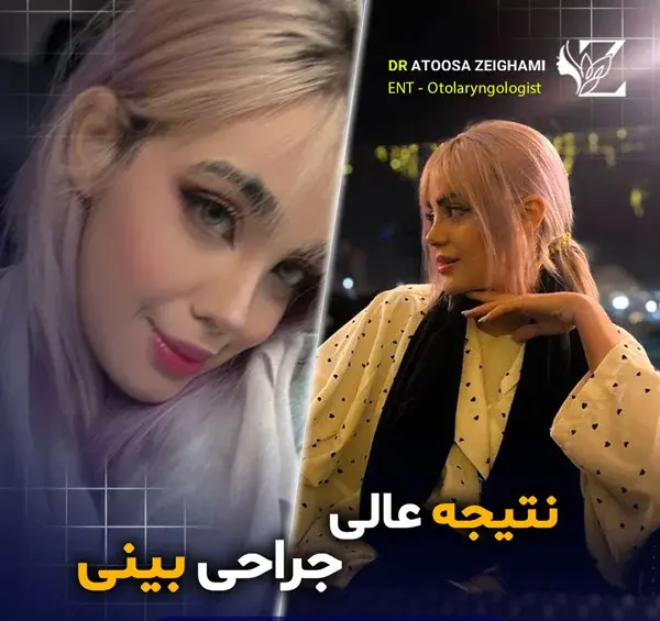 عکس بینی فانتزی عروسکی