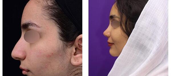 عکس بینی فانتزی عروسکی