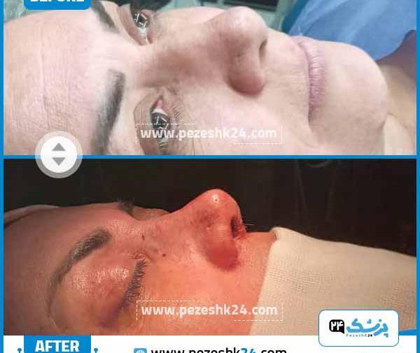 عکس فانتزی شیراز