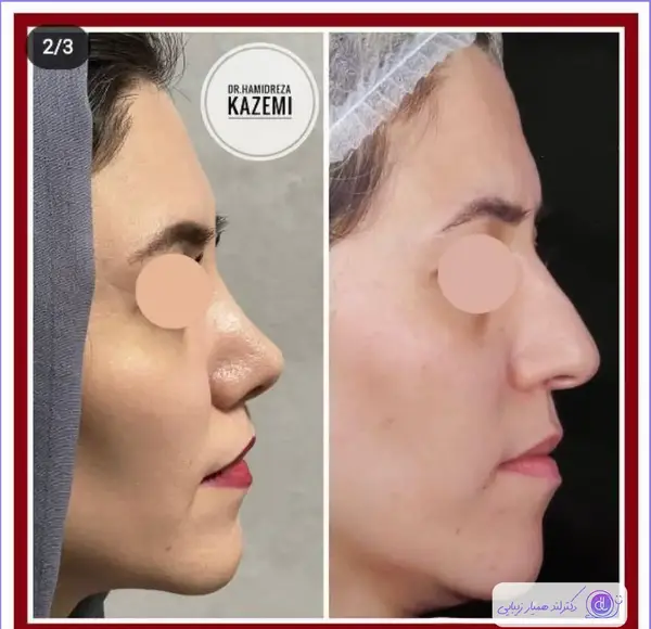 عکس فانتزی شیراز