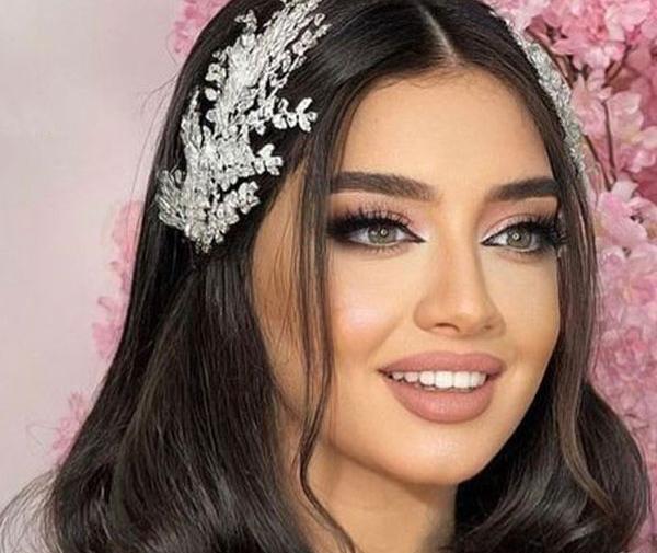 عکس زشت ترین عروس