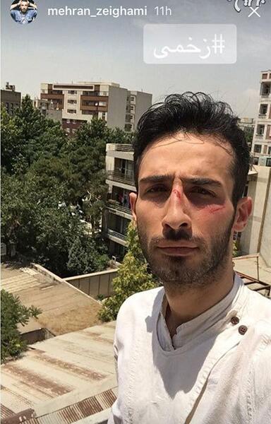 عکس های عروسی مهران ضیغمی