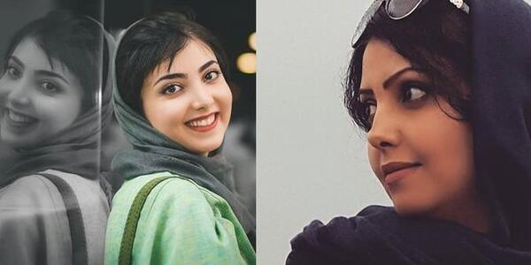 عکس زیبا کرمعلی قبل از عمل بینی