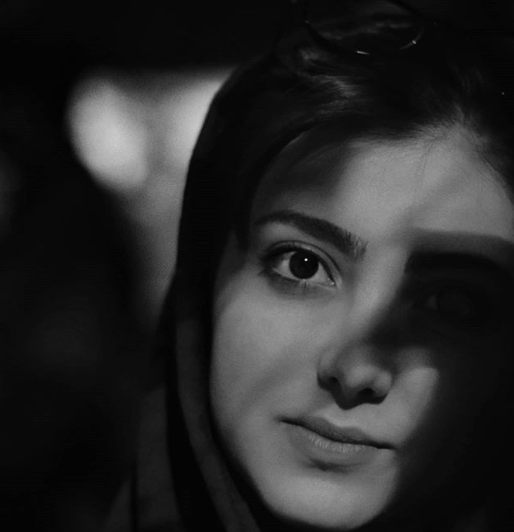 عکس زیبا کرمعلی قبل از عمل بینی