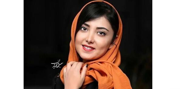 عکس زیبا کرمعلی قبل از عمل بینی