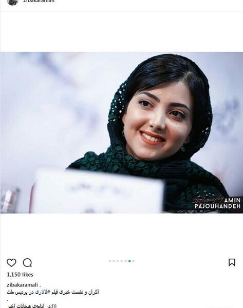 عکس زیبا کرمعلی قبل از عمل بینی