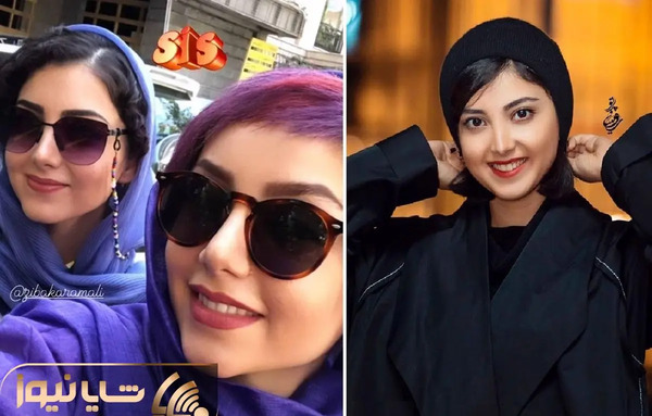 عکس زیبا کرمعلی قبل از عمل بینی