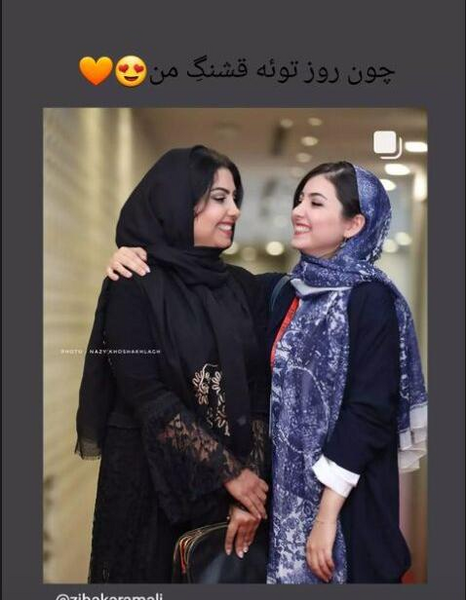 عکس زیبا کرمعلی قبل از عمل بینی