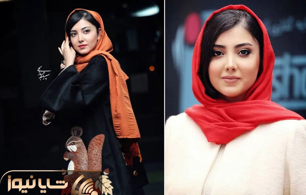 عکس زیبا کرمعلی قبل از عمل بینی