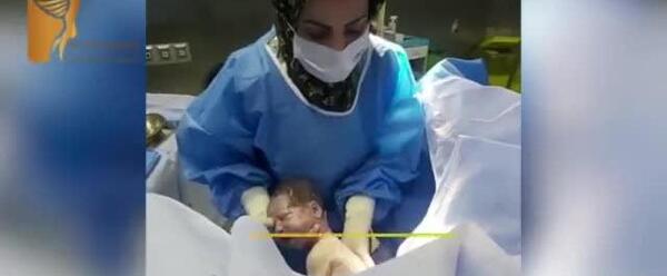 عکس زایمان طبیعی از روبرو لحظه خروج نوزاد