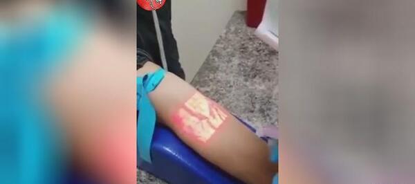 عکس شاهرگ زدن دست