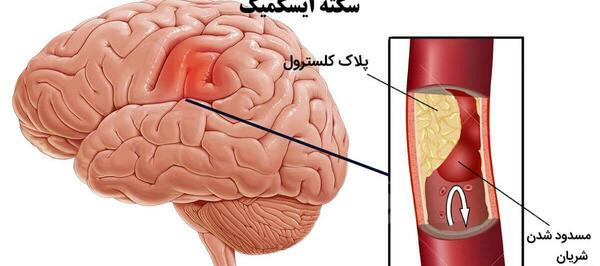 عکس شاهرگ اصلی دست کجاست