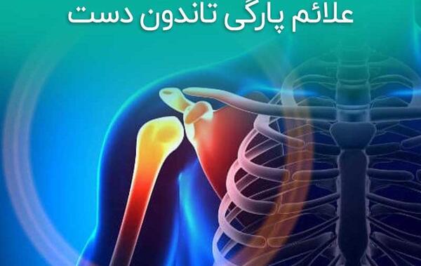 عکس شاهرگ اصلی دست کجاست