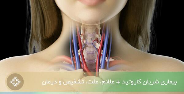 عکس شاهرگ اصلی دست کجاست