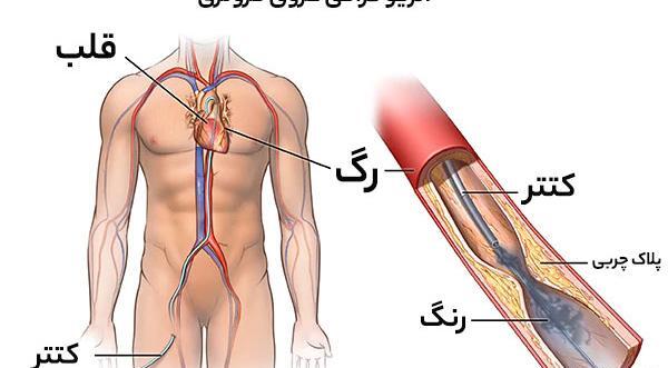 عکس شاهرگ اصلی دست کجاست