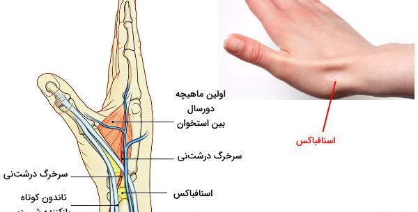 عکس شاهرگ اصلی دست کجاست