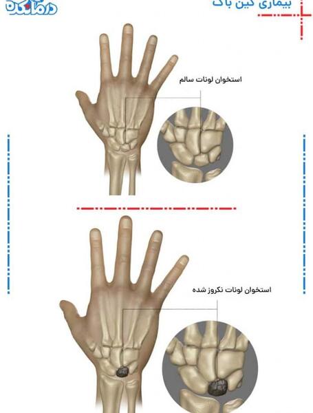 عکس شاهرگ اصلی دست کجاست