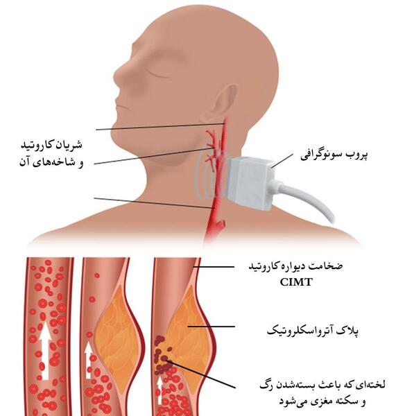 عکس شاهرگ اصلی دست کجاست