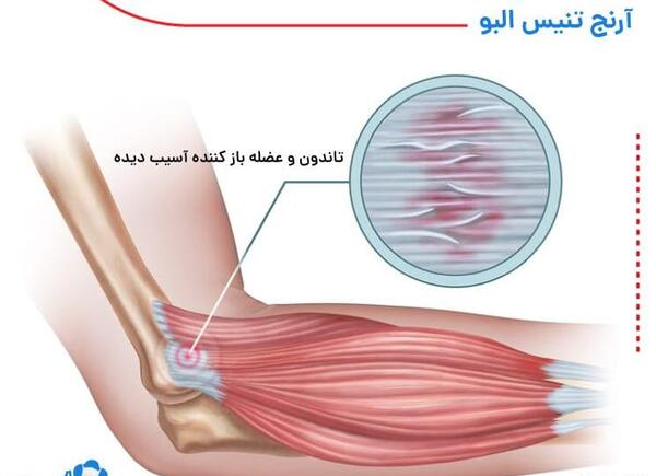 عکس شاهرگ اصلی دست کجاست