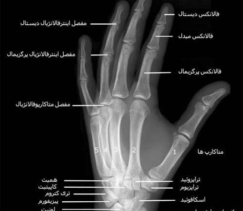 عکس شاهرگ اصلی دست کجاست