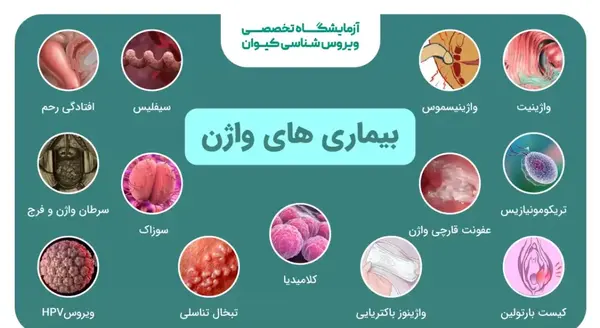 عکس اعضای بدن زن با اسم
