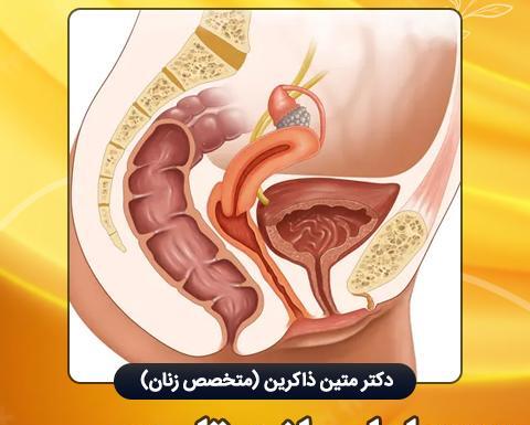 عکس اعضای بدن زن با اسم