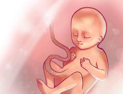 عکس سه بعدی جنین 25 هفته