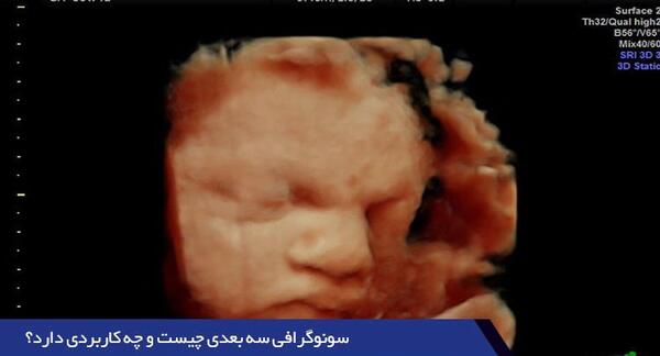 عکس سه بعدی جنین 25 هفته