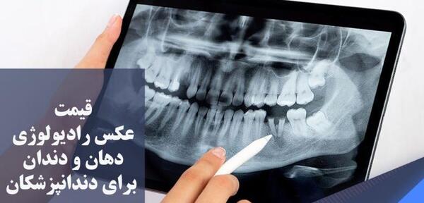 عکس سه بعدی دندان عقل