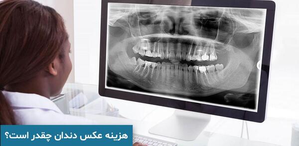 عکس سه بعدی دندان عقل