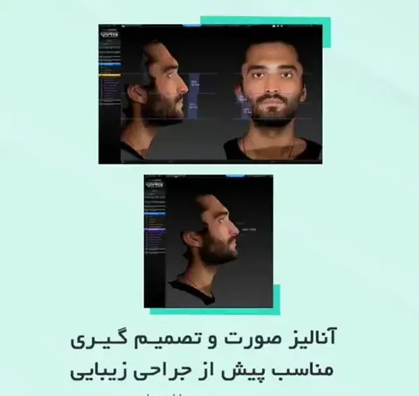 عکس سه بعدی قبل از عمل بینی
