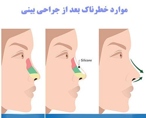 عکس سه بعدی قبل از عمل بینی