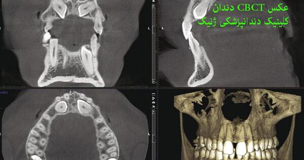 هزینه عکس سه بعدی فک