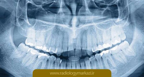 هزینه عکس سه بعدی فک