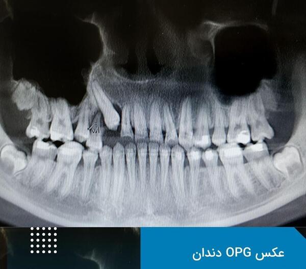 هزینه عکس سه بعدی فک