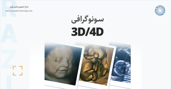 عکس سونوگرافی سه بعدی جنین