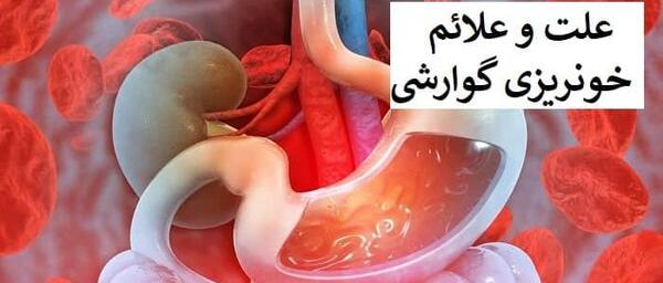 عکس سه بعدی دستگاه گوارش