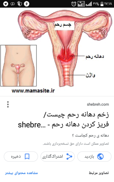 عکس سه بعدی رحم نی نی سایت
