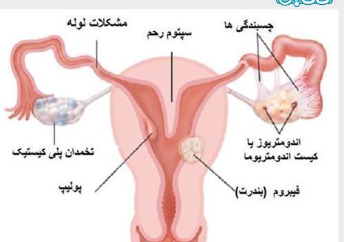 عکس سه بعدی رحم نی نی سایت