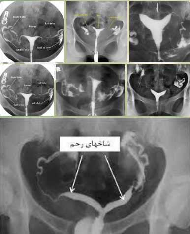 عکس رنگی سه بعدی رحم