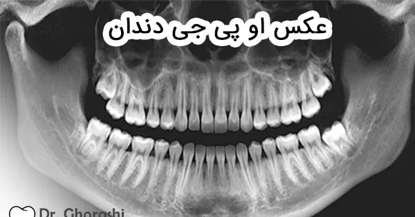عکس سه بعدی دندان چیست
