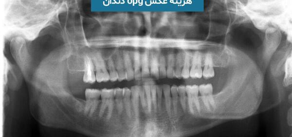 عکس سه بعدی دندان چیست