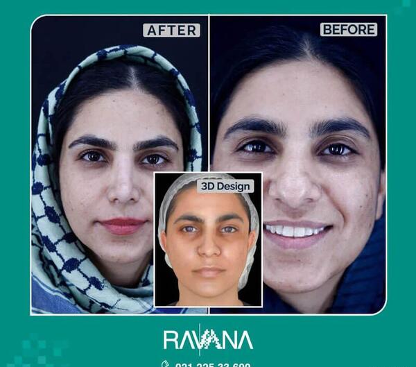 عکس چهره های سه بعدی
