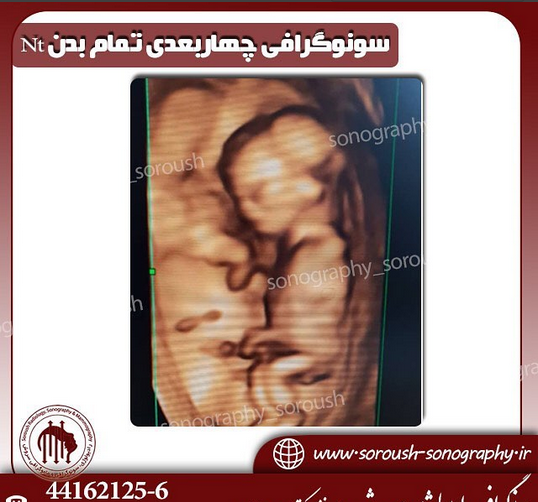 عکس سه بعدی رحم چیست
