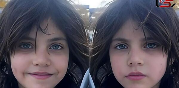 عکس زشت ترین پسر بچه دنیا